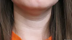 Paljastaa iän hetkessä: miten päästä eroon kaulan Venuksen renkaista